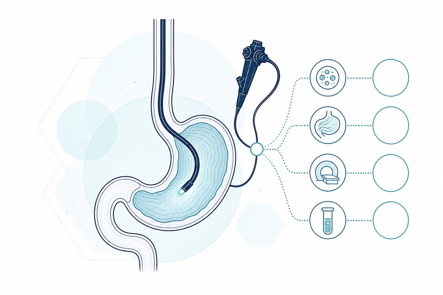 Illustrazione schematica: Come si diagnostica la MRGE: visita, gastroscopia e diagnosi alternative