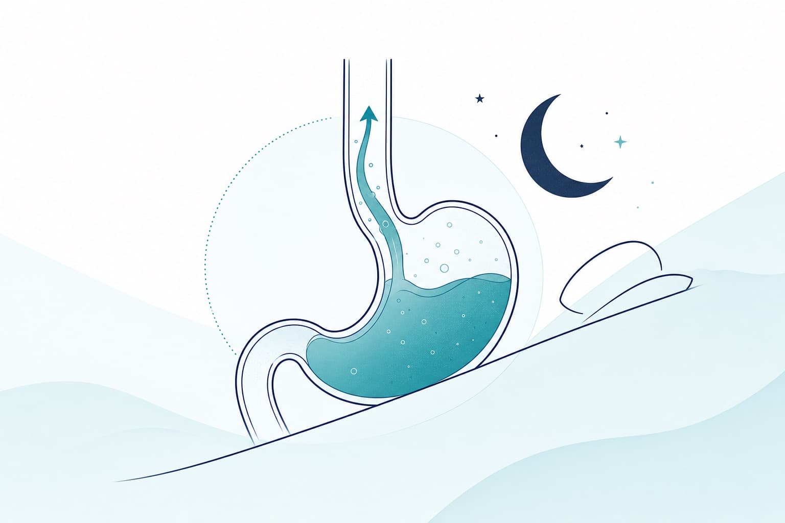 Illustrazione schematica: Bruciore, rigurgito e reflusso notturno: riconoscere i sintomi